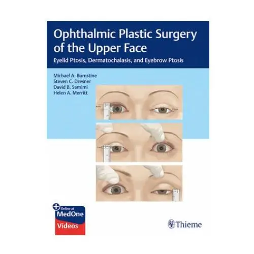 Ophthalmic plastic surgery of the upper face Thieme medical publishers inc