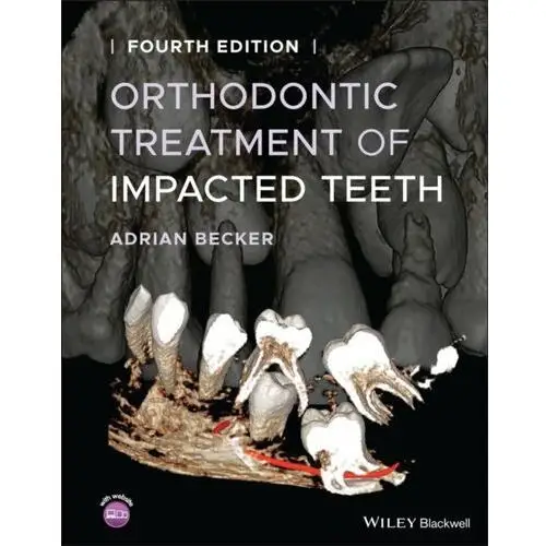 Orthodontic Treatment of Impacted Teeth