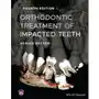 Orthodontic Treatment of Impacted Teeth Sklep on-line