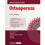 Osteoporoza Sklep on-line