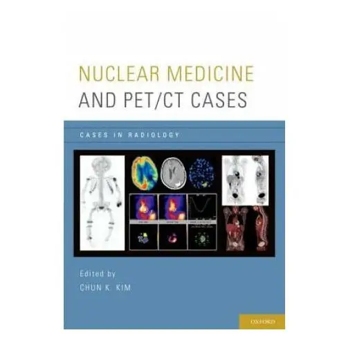 Oup usa Nuclear medicine and pet/ct cases