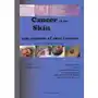 Cancer of the skin - case reports of skin tumors Sklep on-line