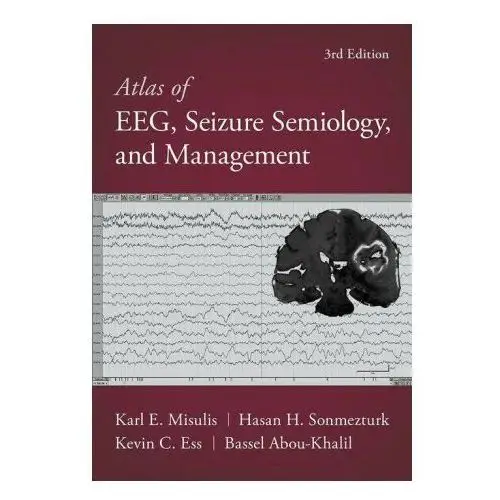 Oxford university press inc Atlas of eeg, seizure semiology, and management