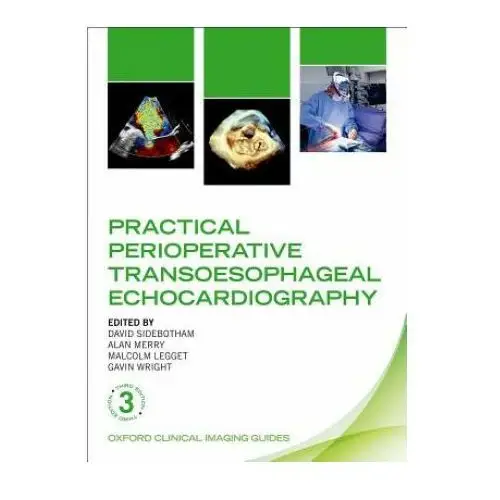 Practical Perioperative Transoesophageal Echocardiography