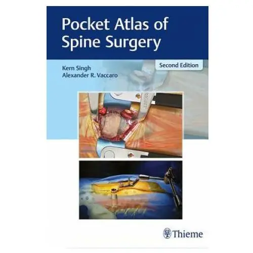 Pocket Atlas of Spine Surgery