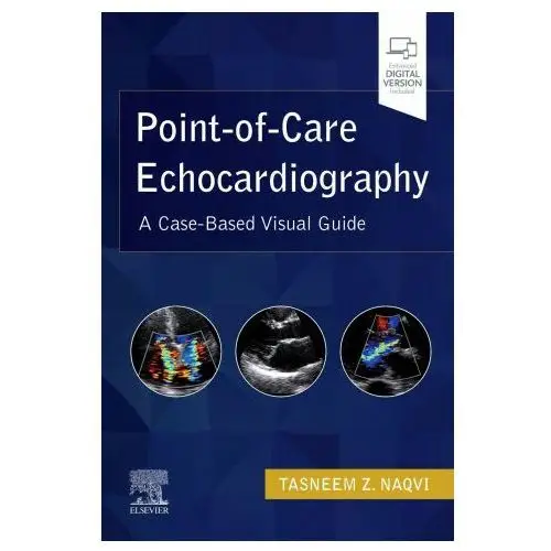 Point-of-care echocardiography Elsevier - health sciences division