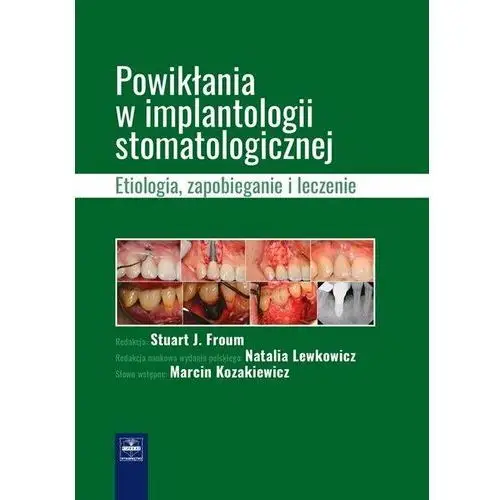 Powikłania w implantologii stomatologicznej. Etiologia, zapobieganie i leczenie