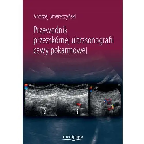 Przewodnik przezskórnej ultrasonografii cewy pokarmowej