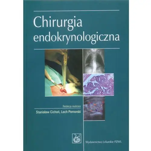 Chirurgia endokrynologiczna Pzwl