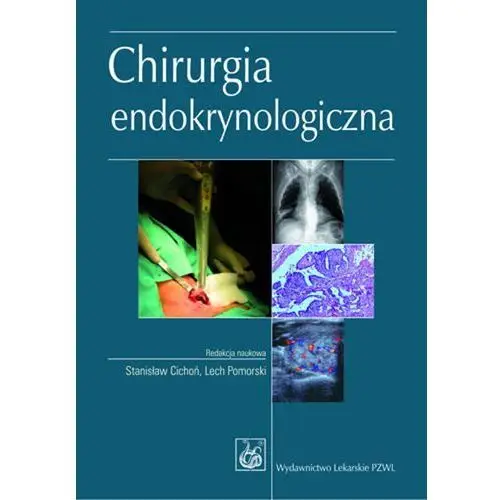 Chirurgia endokrynologiczna