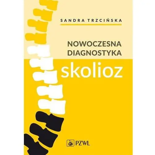 Nowoczesna diagnostyka skolioz