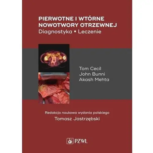 Pierwotne i wtórne nowotwory otrzewnej Pzwl