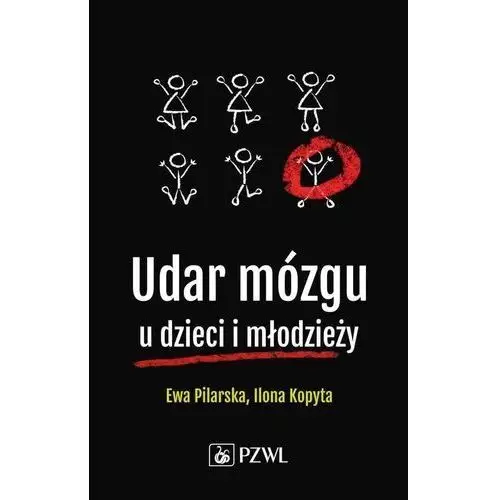 Pzwl Udar mózgu u dzieci i młodzieży