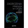 Zagrożenia infekcyjne w ciąży, AZ#F546DA2FEB/DL-ebwm/epub Sklep on-line