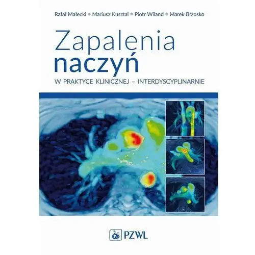 Zapalenia naczyń – w praktyce klinicznej interdyscyplinarnie Pzwl