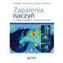 Zapalenia naczyń – w praktyce klinicznej interdyscyplinarnie Pzwl Sklep on-line