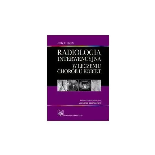 Radiologia interwencyjna w leczeniu chorób u kobiet