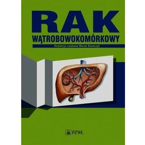 Rak wątrobowokomórkowy