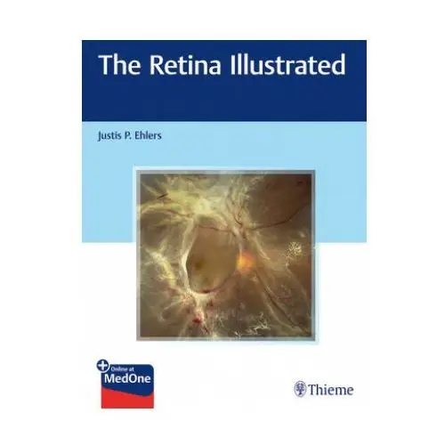 Retina illustrated Thieme medical publishers inc