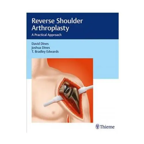 Reverse Shoulder Arthroplasty