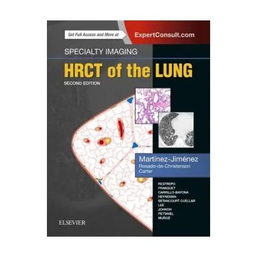 Specialty Imaging: HRCT of the Lung