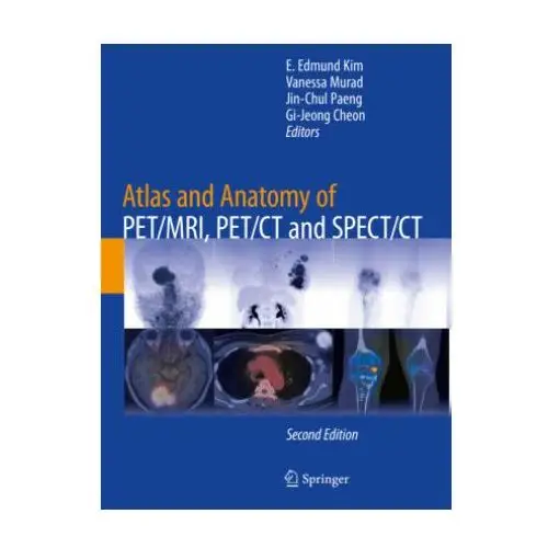 Atlas and anatomy of pet/mri, pet/ct and spect/ct Springer, berlin