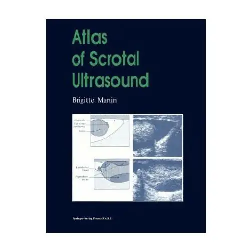 Atlas of scrotal ultrasound, 1 Springer, berlin