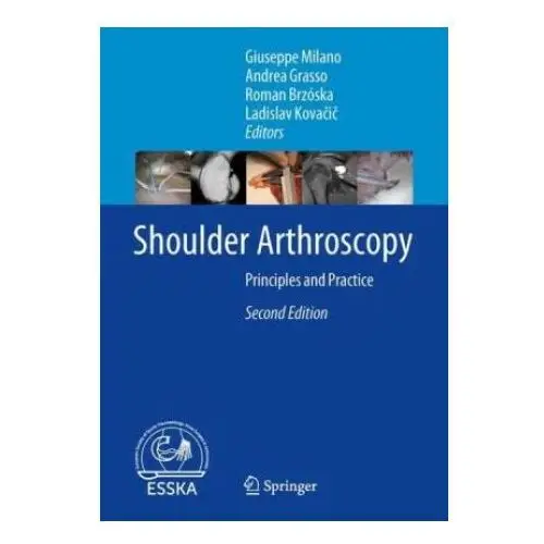 Shoulder Arthroscopy