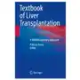 Textbook of liver transplantation Springer, berlin Sklep on-line