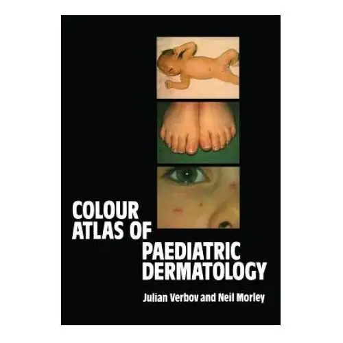 Colour Atlas of Paediatric Dermatology