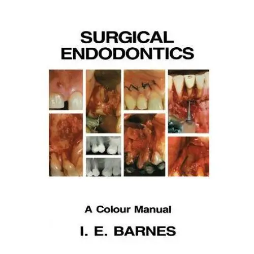 Surgical Endodontics