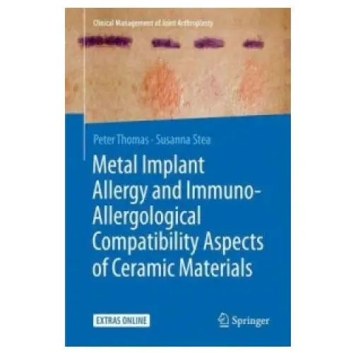 Springer-verlag berlin and heidelberg gmbh & co. kg Metal implant allergy and immuno-allergological compatibility aspects of ceramic materials