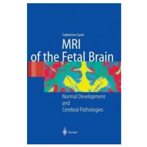 Springer-verlag berlin and heidelberg gmbh & co. kg Mri of the fetal brain