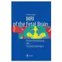 Springer-verlag berlin and heidelberg gmbh & co. kg Mri of the fetal brain Sklep on-line