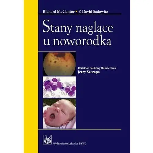 Stany naglące u noworodka