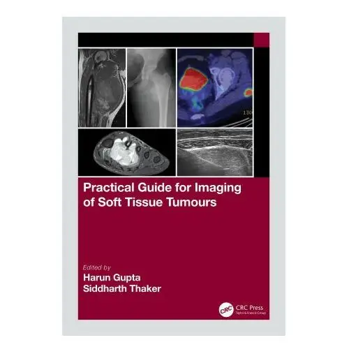 Practical Guide for Imaging of Soft Tissue Tumours