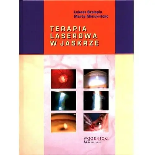 Terapia laserowa w jaskrze