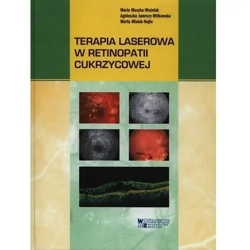 Terapia laserowa w retinopatii cukrzycowej