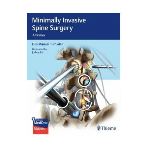 Thieme medical publishers inc Minimally invasive spine surgery