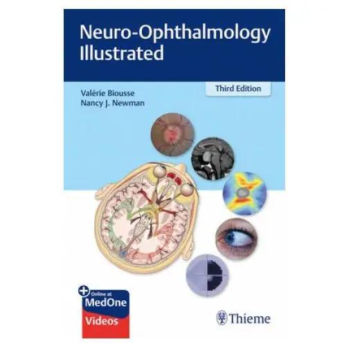 Thieme medical publishers inc Neuro-ophthalmology illustrated