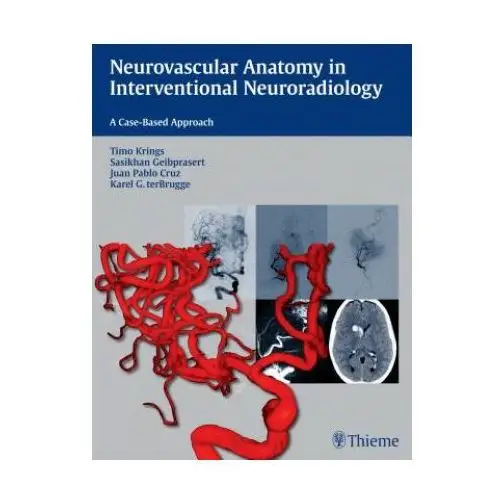 Thieme medical publishers inc Neurovascular anatomy in interventional neuroradiology
