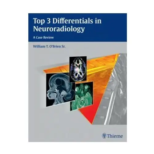 Thieme medical publishers inc Top 3 differentials in neuroradiology