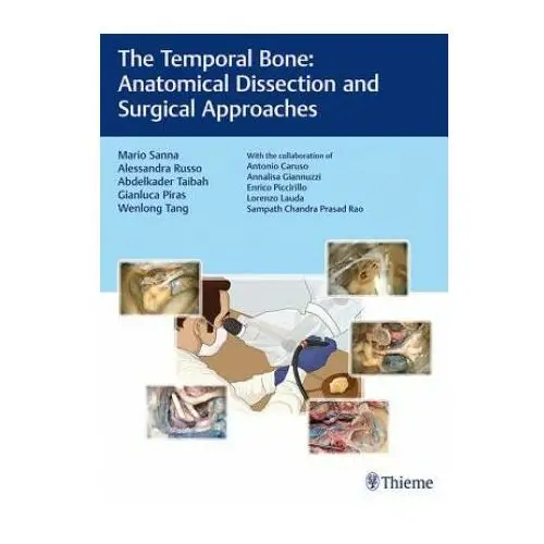 Temporal bone Thieme publishing group