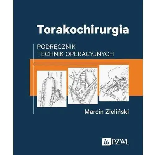 Torakochirurgia. Podręcznik technik operacyjnych