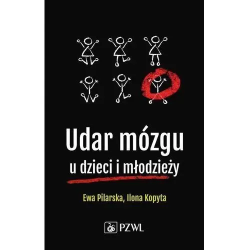 Udar mózgu u dzieci i młodzieży