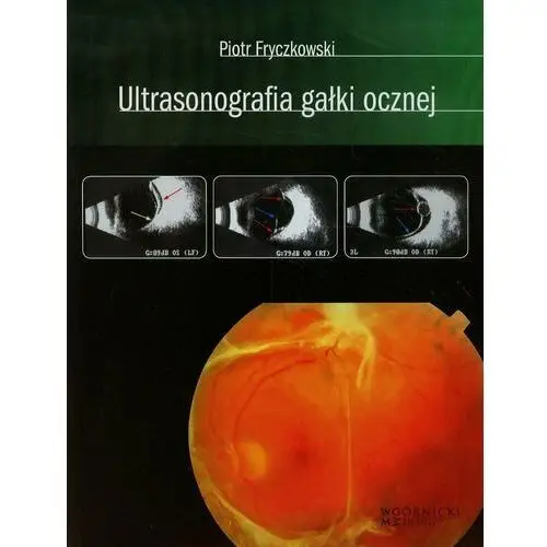 Ultrasonografia gałki ocznej