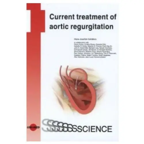 Current treatment of aortic regurgitation Uni-med, bremen