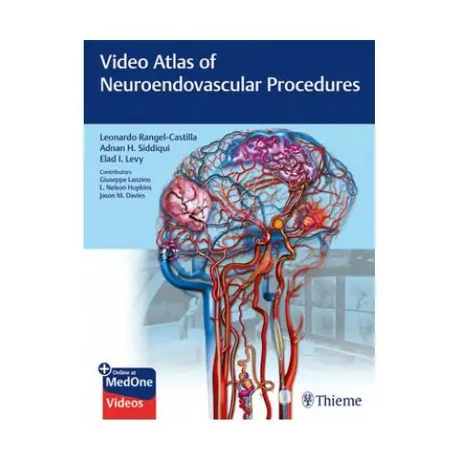 Video atlas of neuroendovascular procedures Thieme medical publishers inc