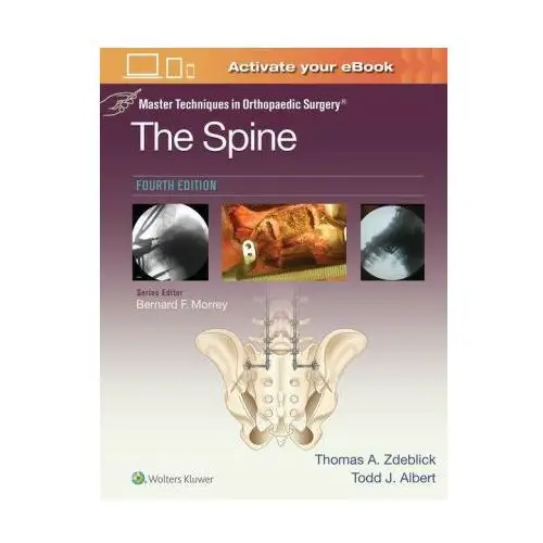 Master Techniques in Orthopaedic Surgery: The Spine