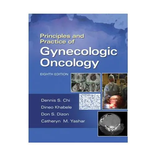 Principles and Practice of Gynecologic Oncology